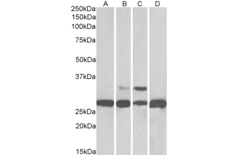 Western Blot - Anti-PGAM1 Antibody (A83678) - Antibodies.com