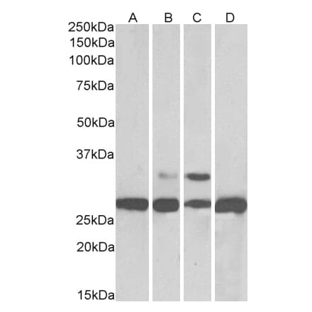 Western Blot - Anti-PGAM1 Antibody (A83678) - Antibodies.com