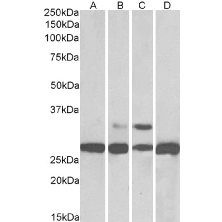 Western Blot - Anti-PGAM1 Antibody (A83678) - Antibodies.com