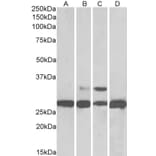 Western Blot - Anti-PGAM1 Antibody (A83678) - Antibodies.com