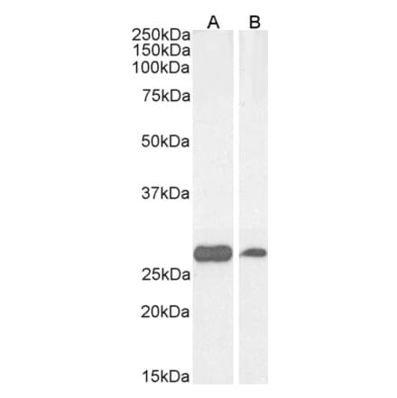 Western Blot - Anti-PGAM1 Antibody (A83678) - Antibodies.com