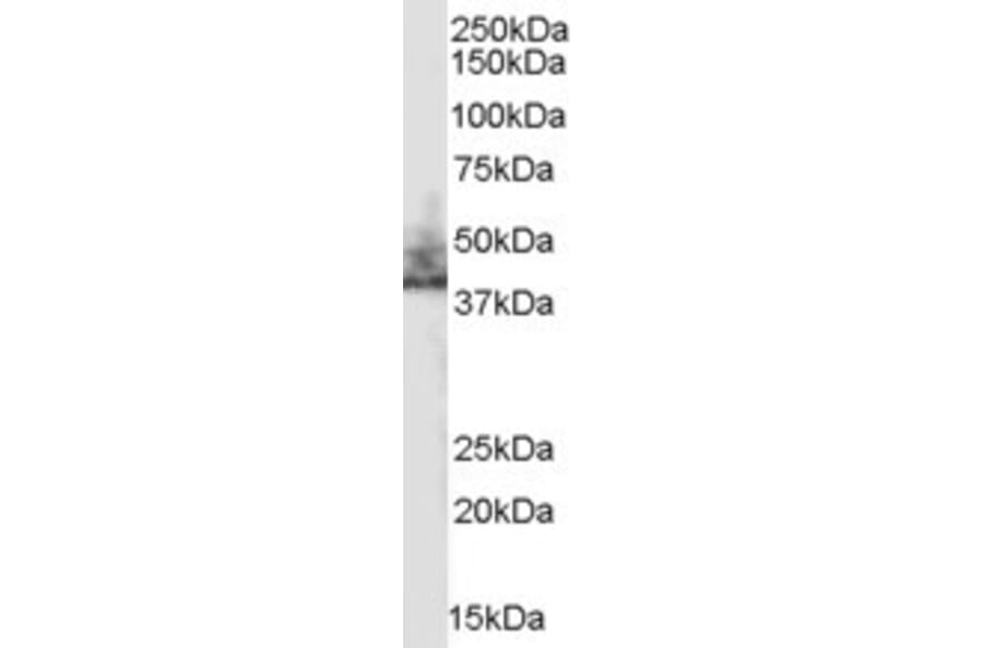 Western Blot - Anti-NHERF-2/SIP-1 Antibody (A83681) - Antibodies.com