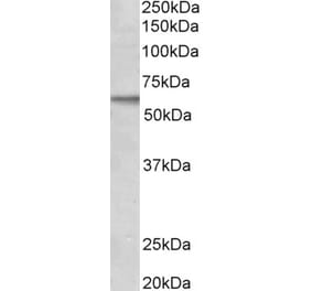 Western Blot - Anti-ALK-1 Antibody (A83682) - Antibodies.com