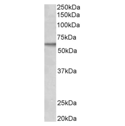 Western Blot - Anti-ALK-1 Antibody (A83682) - Antibodies.com