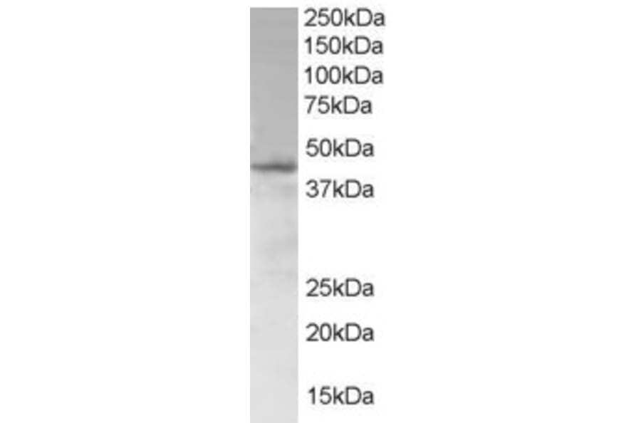 Western Blot - Anti-SAMSN1 Antibody (A83683) - Antibodies.com