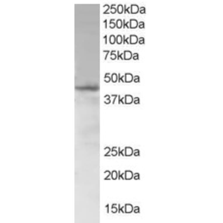 Western Blot - Anti-SAMSN1 Antibody (A83683) - Antibodies.com
