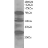 Western Blot - Anti-LMO7 Antibody (A83684) - Antibodies.com