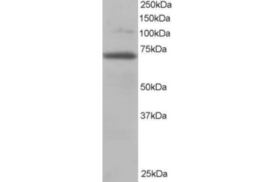 Western Blot - Anti-RanGAP1 Antibody (A83685) - Antibodies.com
