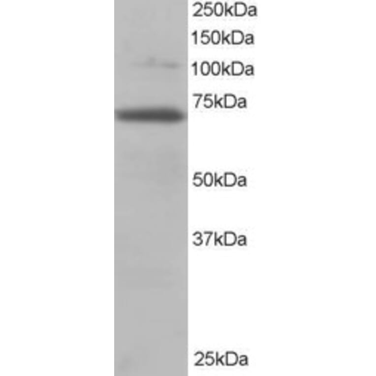 Western Blot - Anti-RanGAP1 Antibody (A83685) - Antibodies.com