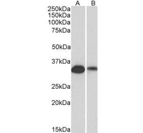 Western Blot - Anti-CD20 Antibody (A83686) - Antibodies.com