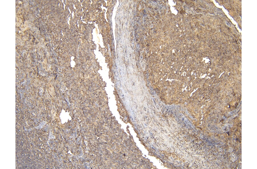 Immunohistochemistry - Anti-CD20 Antibody (A83686) - Antibodies.com