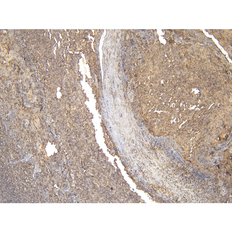 Immunohistochemistry - Anti-CD20 Antibody (A83686) - Antibodies.com