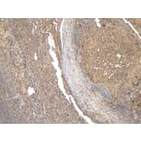 Immunohistochemistry - Anti-CD20 Antibody (A83686) - Antibodies.com