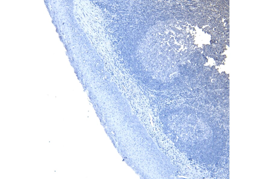 Immunohistochemistry - Anti-CD20 Antibody (A83686) - Antibodies.com