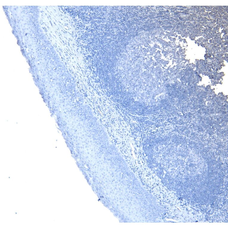 Immunohistochemistry - Anti-CD20 Antibody (A83686) - Antibodies.com