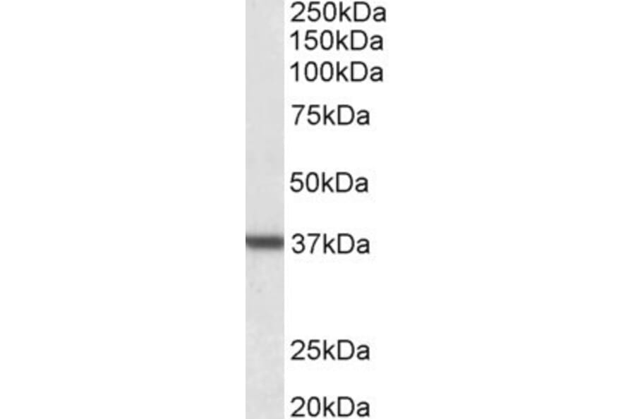 Western Blot - Anti-Liver Arginase Antibody (A83687) - Antibodies.com