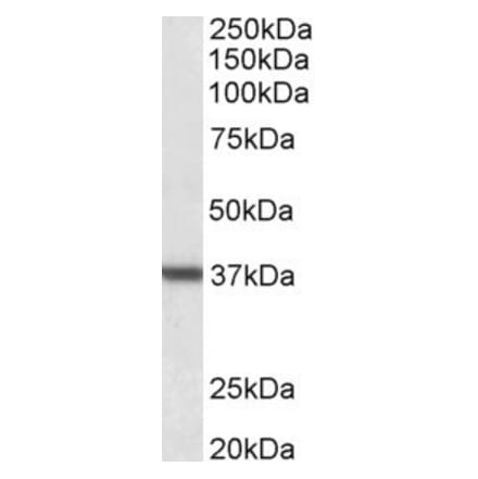 Western Blot - Anti-Liver Arginase Antibody (A83687) - Antibodies.com