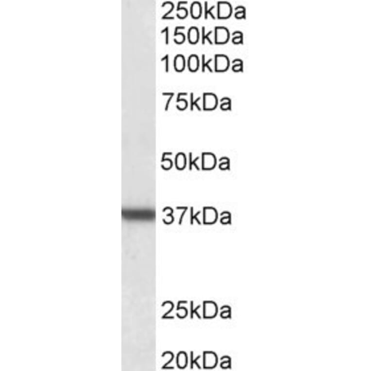 Western Blot - Anti-Liver Arginase Antibody (A83687) - Antibodies.com