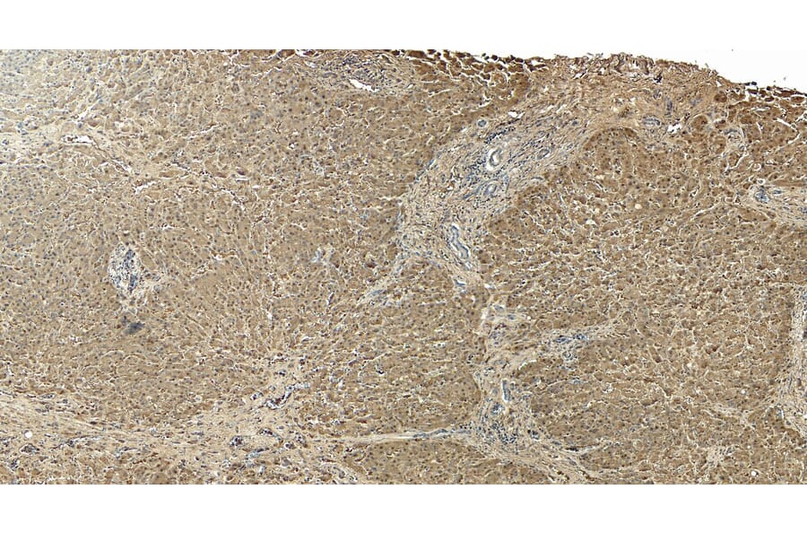 Immunohistochemistry - Anti-Liver Arginase Antibody (A83687) - Antibodies.com