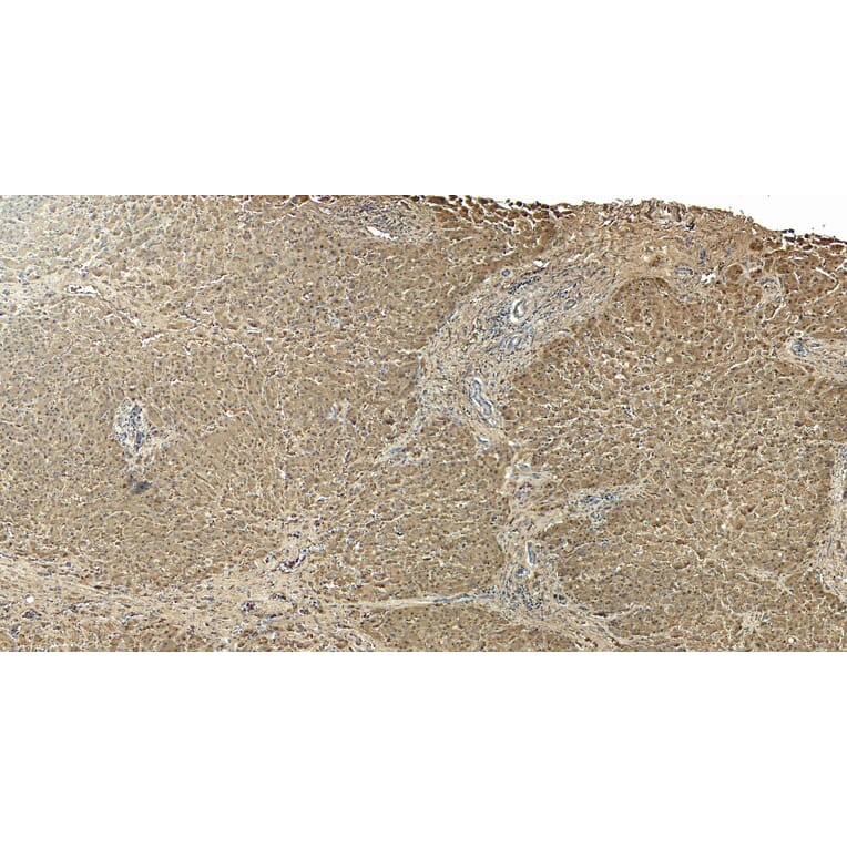 Immunohistochemistry - Anti-Liver Arginase Antibody (A83687) - Antibodies.com