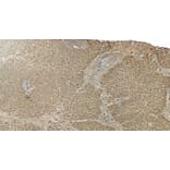 Immunohistochemistry - Anti-Liver Arginase Antibody (A83687) - Antibodies.com