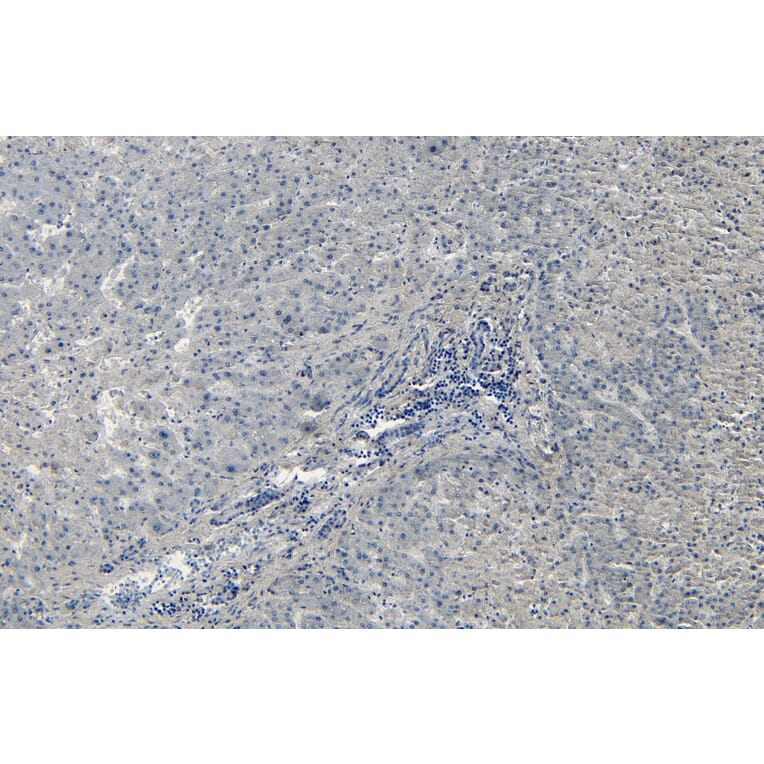 Immunohistochemistry - Anti-Liver Arginase Antibody (A83687) - Antibodies.com