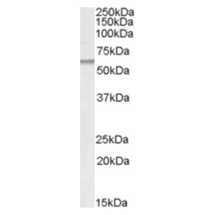 Western Blot - Anti-Adipose Triglyceride Lipase Antibody (A83688) - Antibodies.com