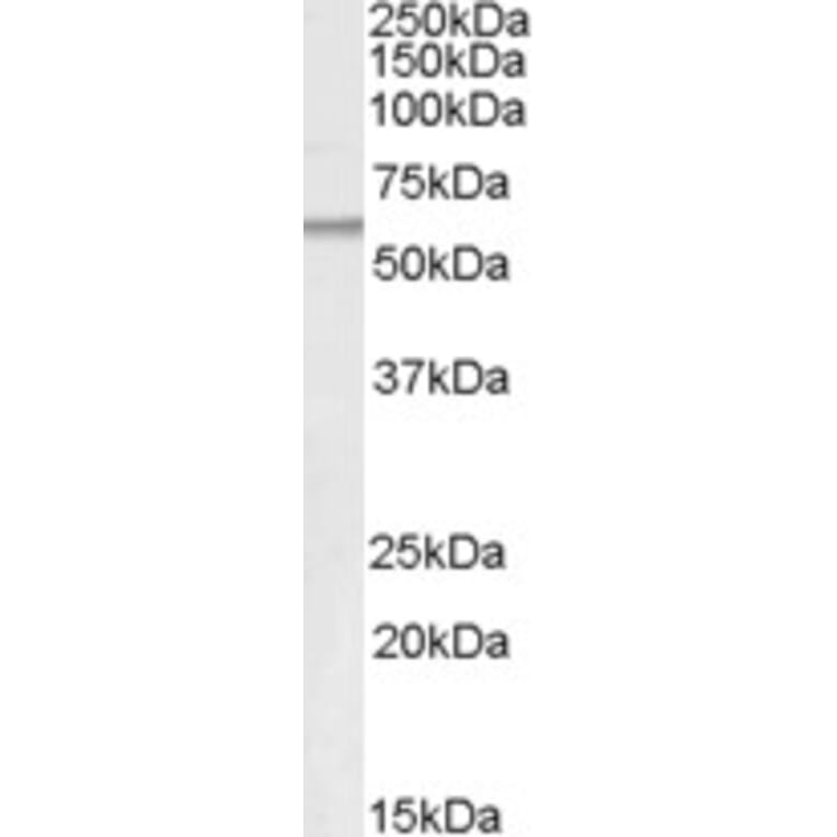 Western Blot - Anti-Adipose Triglyceride Lipase Antibody (A83688) - Antibodies.com