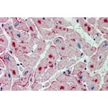 Immunohistochemistry - Anti-Adipose Triglyceride Lipase Antibody (A83688) - Antibodies.com