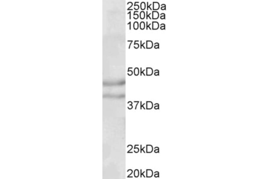 Western Blot - Anti-NPY2R/Y2 Receptor Antibody (A83689) - Antibodies.com