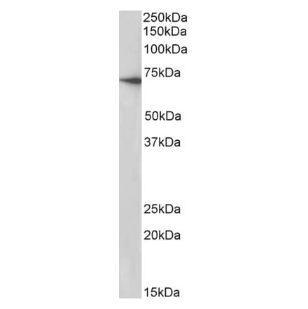 Western Blot - Anti-BCRP/ABCG2 Antibody (A83690) - Antibodies.com