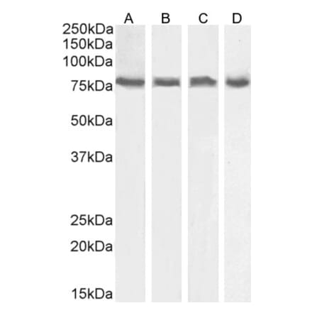 Western Blot - Anti-ELMO2 Antibody (A83692) - Antibodies.com