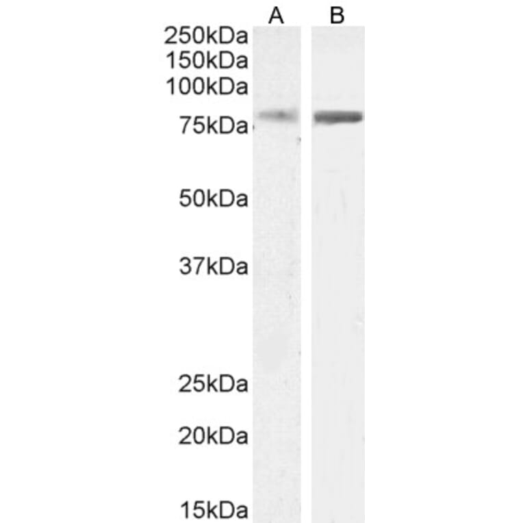 Western Blot - Anti-ELMO2 Antibody (A83692) - Antibodies.com