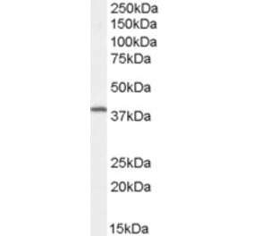 Western Blot - Anti-Dysadherin Antibody (A83693) - Antibodies.com