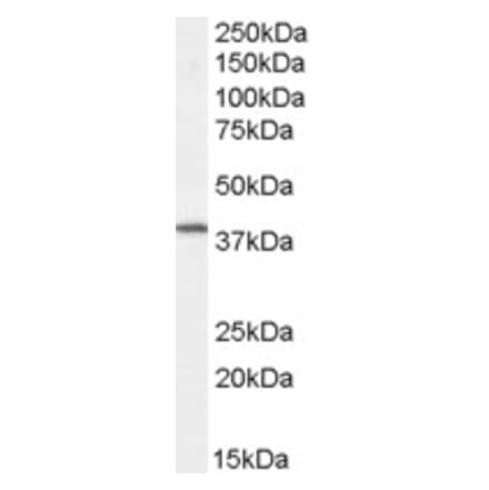 Western Blot - Anti-Dysadherin Antibody (A83693) - Antibodies.com