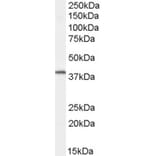 Western Blot - Anti-Dysadherin Antibody (A83693) - Antibodies.com