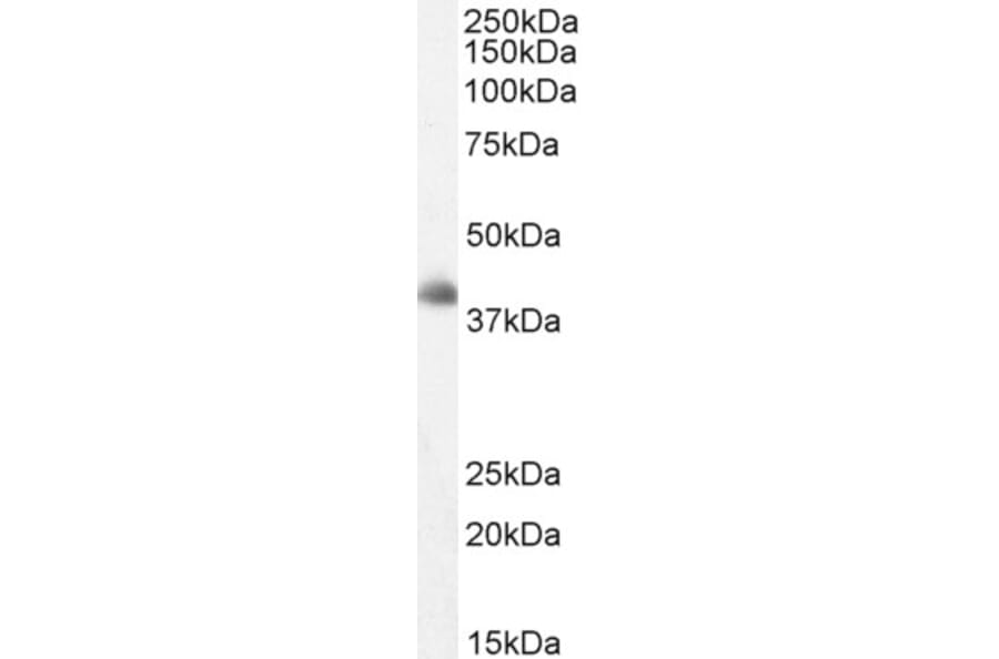 Western Blot - Anti-Dkk3 Antibody (A83694) - Antibodies.com