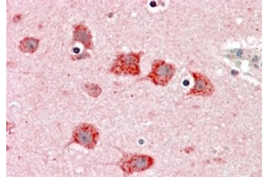 Immunohistochemistry - Anti-Dkk3 Antibody (A83694) - Antibodies.com