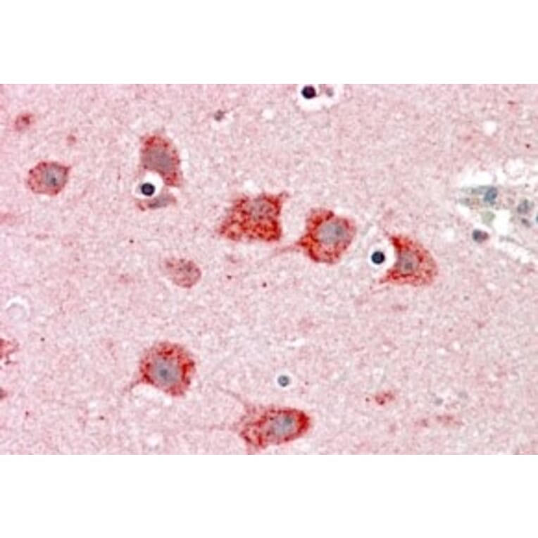 Immunohistochemistry - Anti-Dkk3 Antibody (A83694) - Antibodies.com