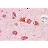 Immunohistochemistry - Anti-Dkk3 Antibody (A83694) - Antibodies.com