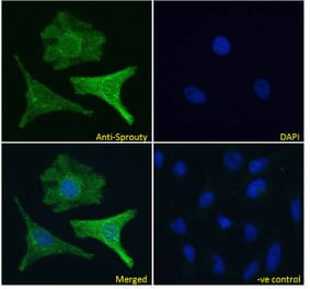 Immunofluorescence - Anti-SPRY1 Antibody (A83695) - Antibodies.com