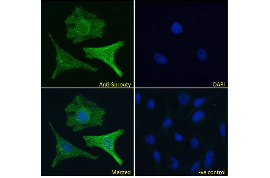 Immunofluorescence - Anti-SPRY1 Antibody (A83695) - Antibodies.com
