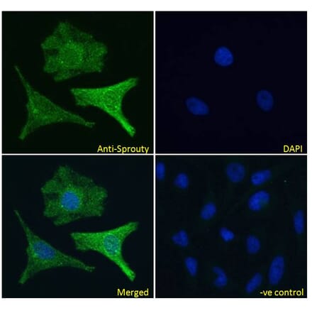 Immunofluorescence - Anti-SPRY1 Antibody (A83695) - Antibodies.com