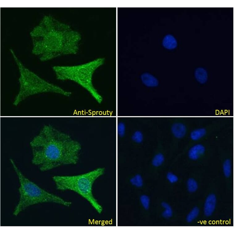 Immunofluorescence - Anti-SPRY1 Antibody (A83695) - Antibodies.com