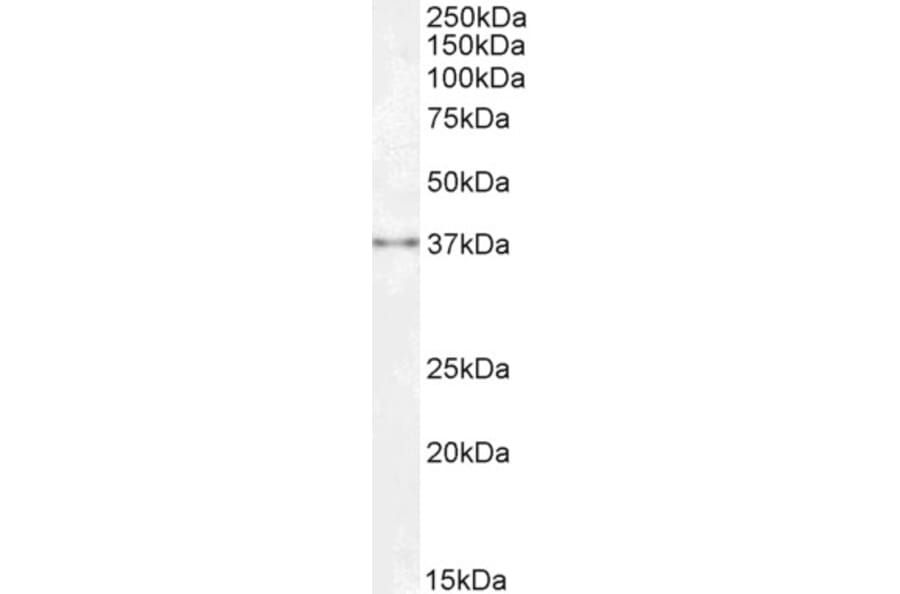 Western Blot - Anti-SPRY1 Antibody (A83695) - Antibodies.com
