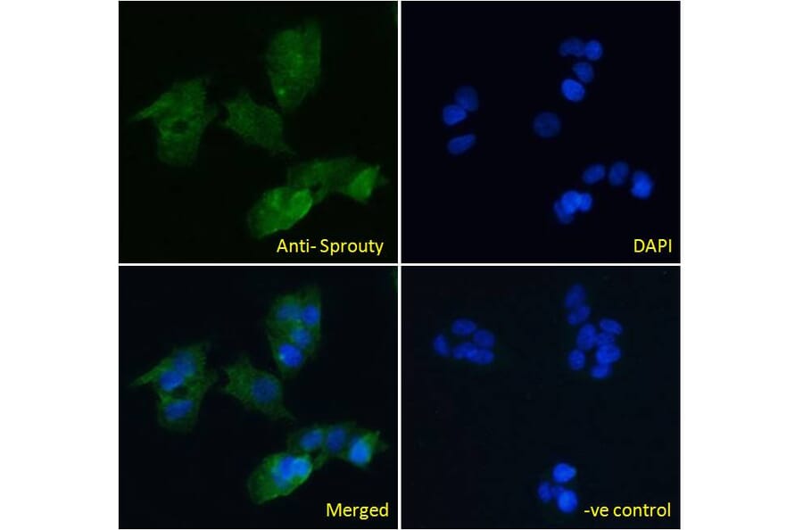 Immunofluorescence - Anti-SPRY1 Antibody (A83695) - Antibodies.com