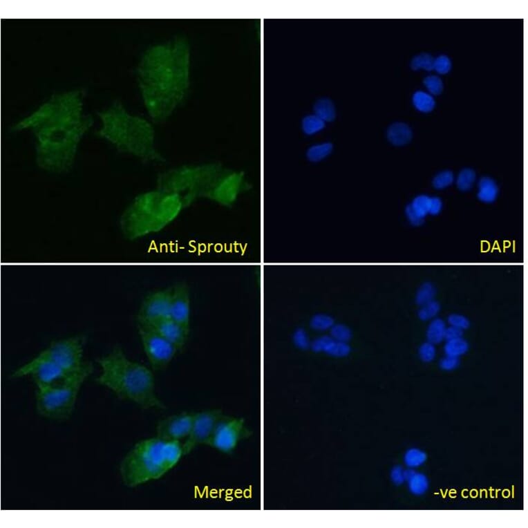 Immunofluorescence - Anti-SPRY1 Antibody (A83695) - Antibodies.com