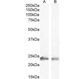 Western Blot - Anti-Transgelin Antibody (A83697) - Antibodies.com