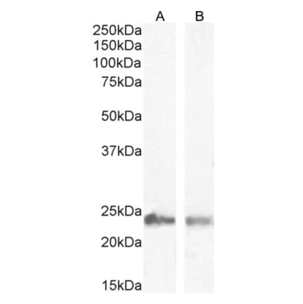 Western Blot - Anti-Transgelin Antibody (A83697) - Antibodies.com