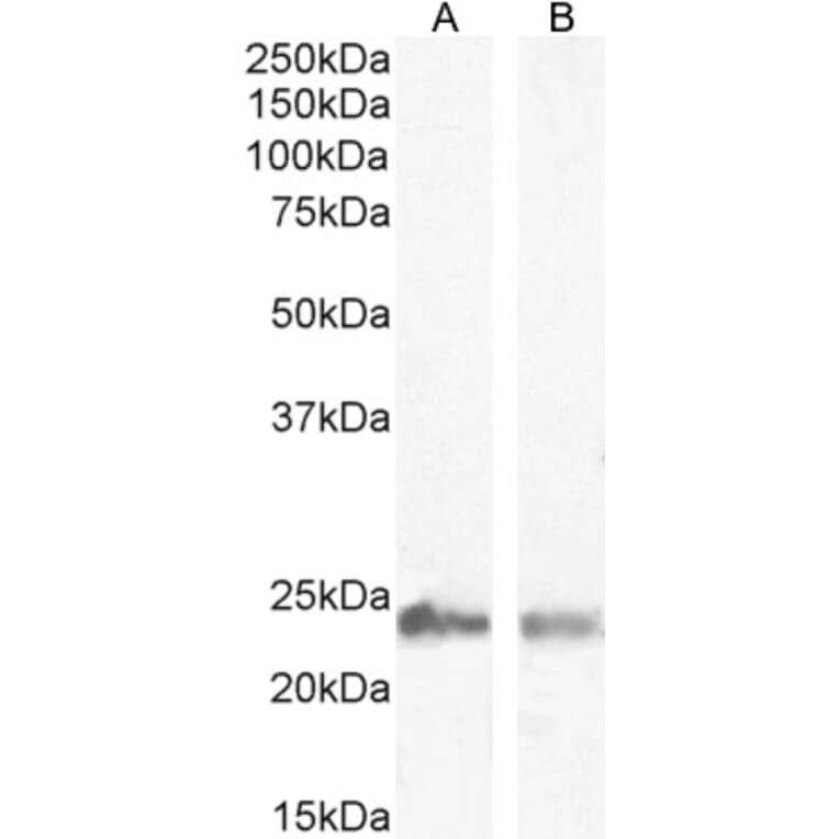 Western Blot - Anti-Transgelin Antibody (A83697) - Antibodies.com